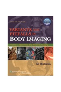 Variants and Pitfalls Body Imaging
