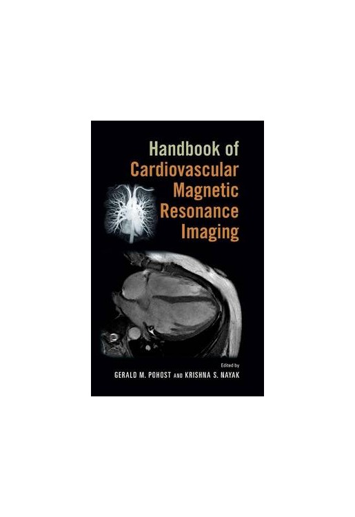 Handbook of Cardiovascular Magnetic Resonance Imaging