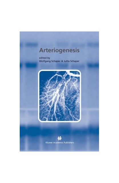 Arteriogenesis