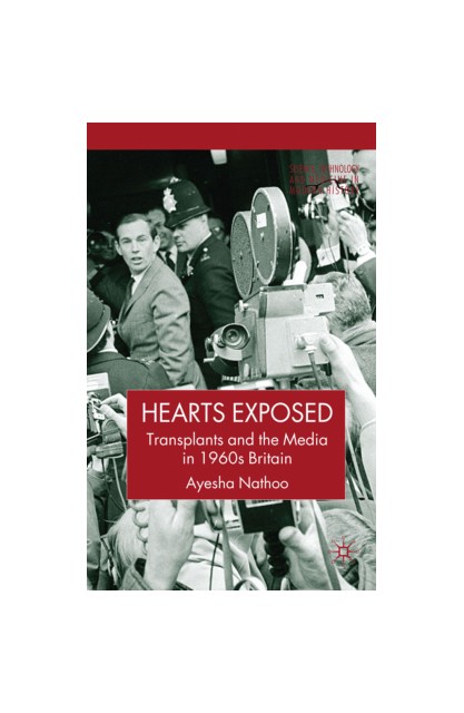 Hearts Exposed