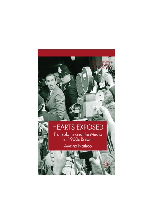 Hearts Exposed