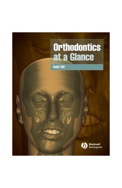 Orthodontics at a Glance