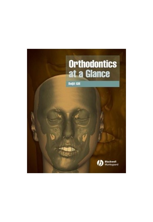 Orthodontics at a Glance