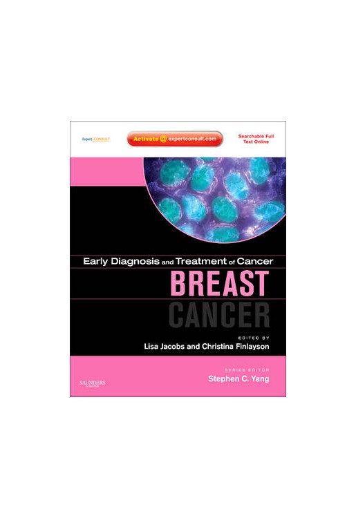 Breast Cancer
