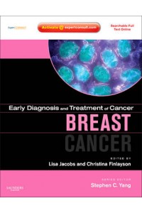 Breast Cancer