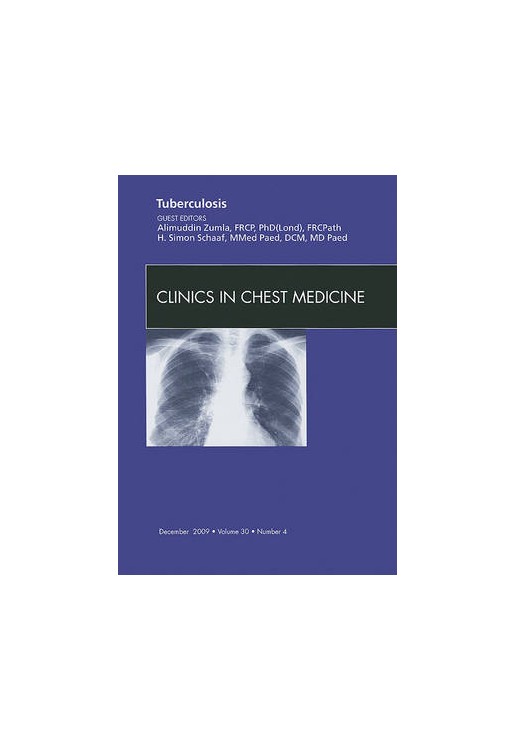 Tuberculosis An Issue of Clinics in Chest Medicine