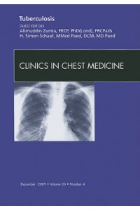 Tuberculosis An Issue of Clinics in Chest Medicine
