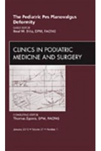 Pediatric Pes Planovalgus Deformity