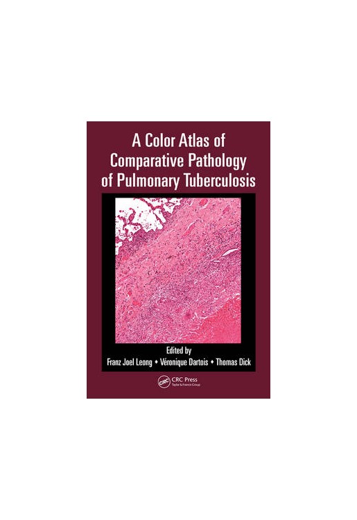Color Atlas of Comparative Pathology of Pulmonary Tuberculos