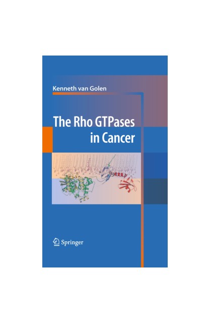 Rho GTPases in Cancer