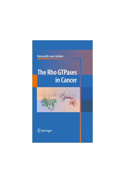 Rho GTPases in Cancer