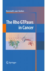 Rho GTPases in Cancer