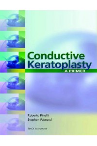 Conductive Keratoplasty