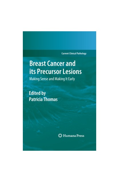 Breast Cancer and its...
