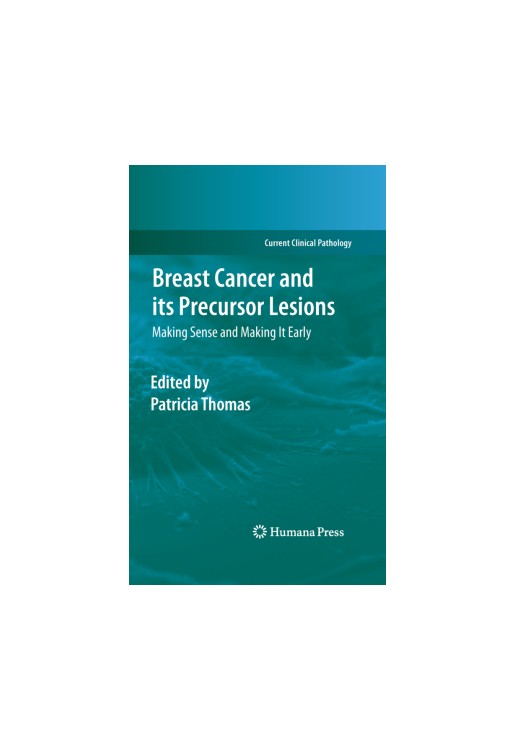Breast Cancer and its Precursor Lesions