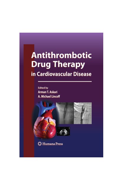 Antithrombotic Drug Therapy...