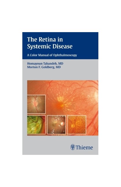 Retina in Systemic Disease