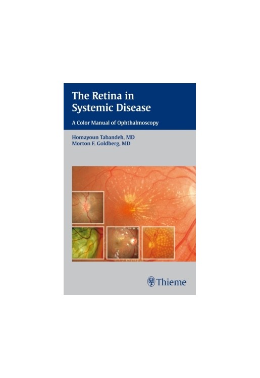 Retina in Systemic Disease
