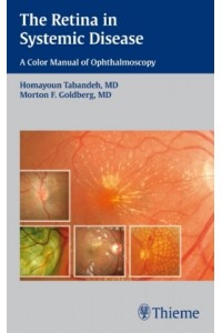 Retina in Systemic Disease