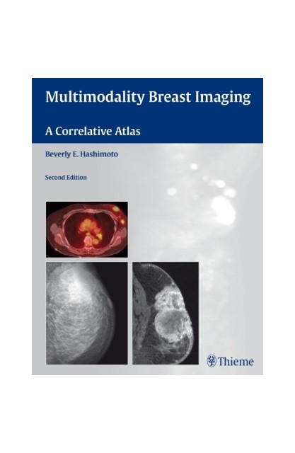 Multimodality Breast...