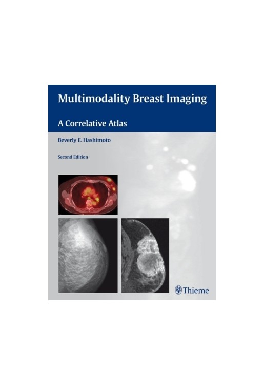 Multimodality Breast Imaging A Correlative Atlas