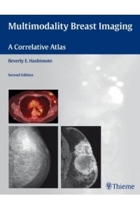 Multimodality Breast Imaging A Correlative Atlas