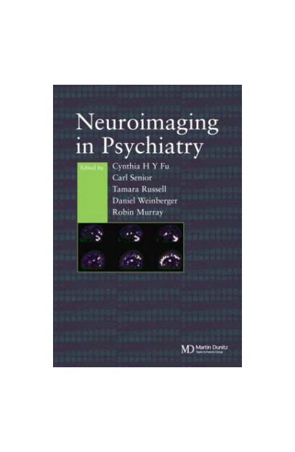 Neuroimaging In Psychiatry