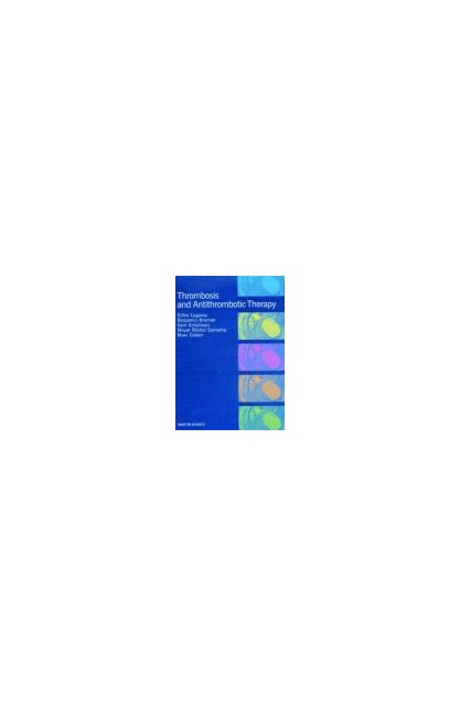 Thrombosis & Cancer