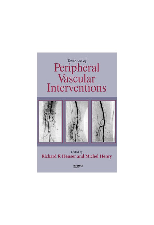 Textbook of Peripheral Vascular Interventions 2e