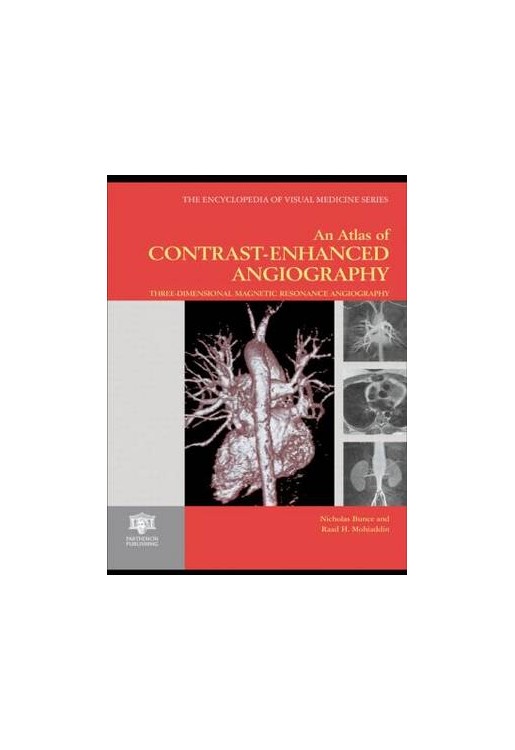 Atlas of Contrast-Enhanced Angiography