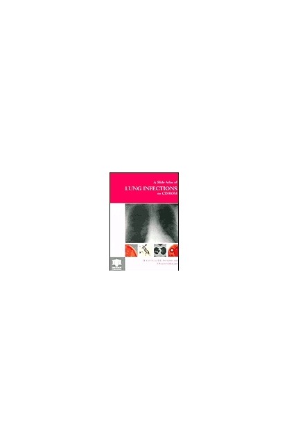 Slide Atlas of Lung...