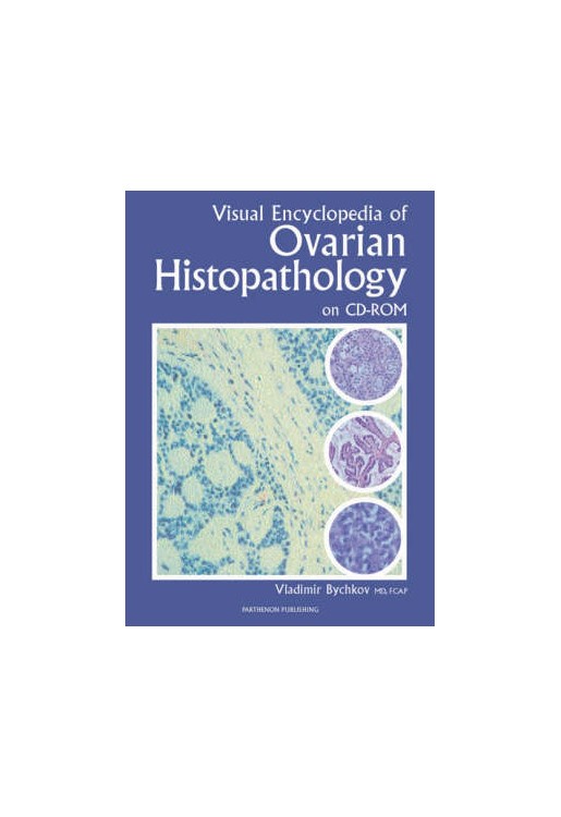 Visual Encyclopedia of Ovarian Histopathology CD