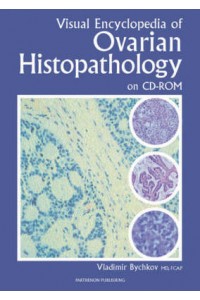 Visual Encyclopedia of Ovarian Histopathology CD