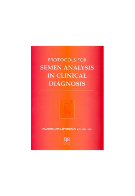 Protocols for Semen Analysis in Clinical Diagnosis