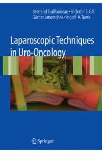 Laparoscopic Techniques in Uro Oncology
