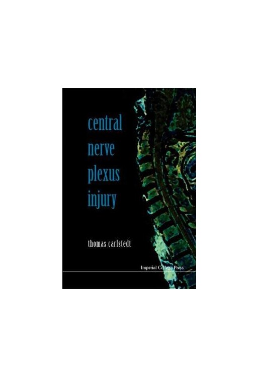 Central Nerve Plexus Injury with CD