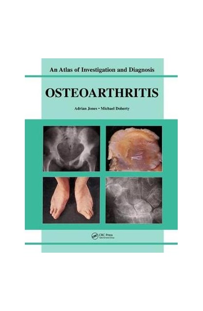 Oesteoarthritis An Atlas of...