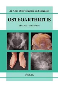 Oesteoarthritis An Atlas of Investigation & Diagnosis