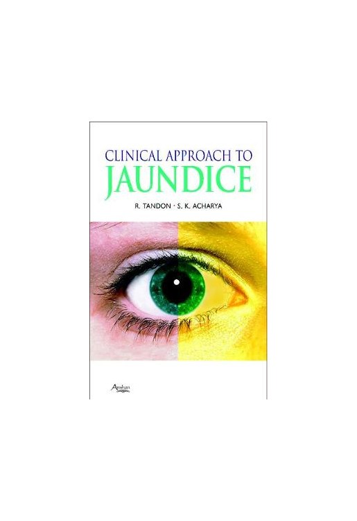 Clinical Approach to Jaundice