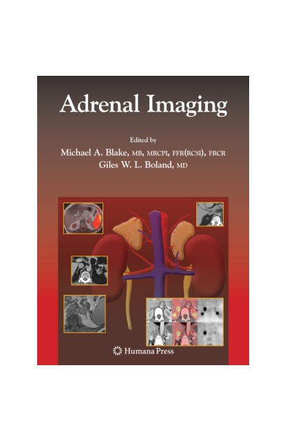 Adrenal Imaging