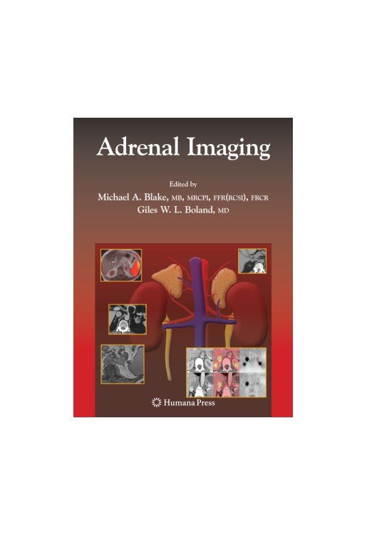 Adrenal Imaging