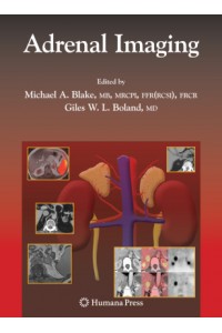 Adrenal Imaging