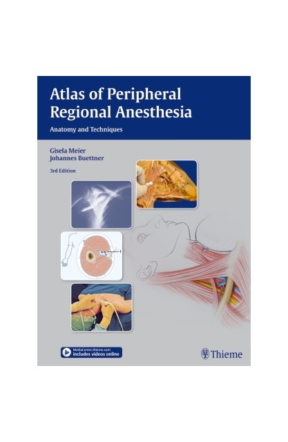 Atlas of Peripheral...