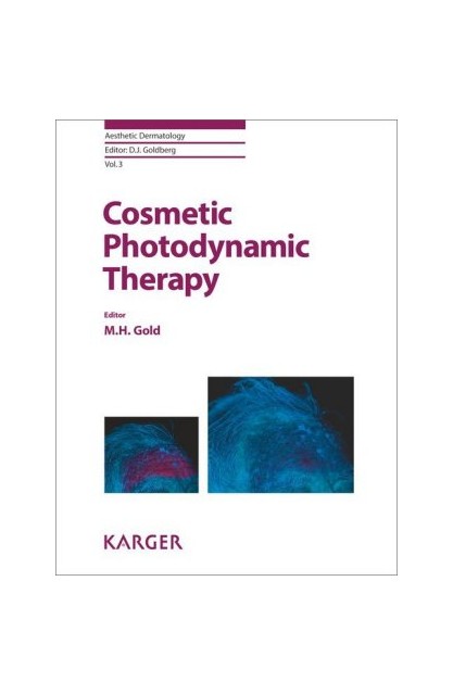 Cosmetic Photodynamic Therapy