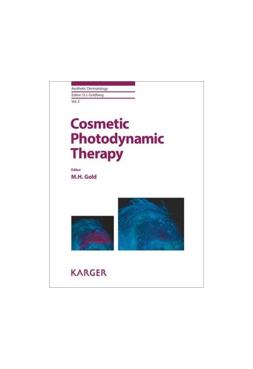 Cosmetic Photodynamic Therapy