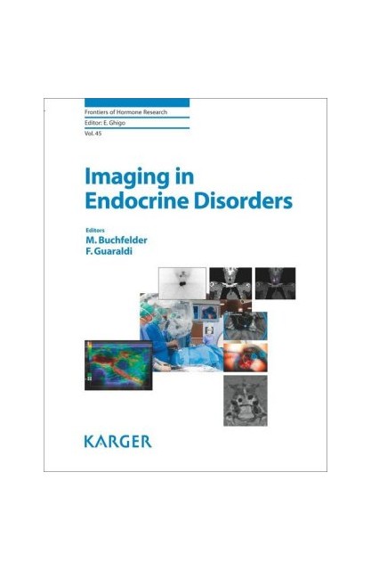 Imaging in Endocrine Disorders