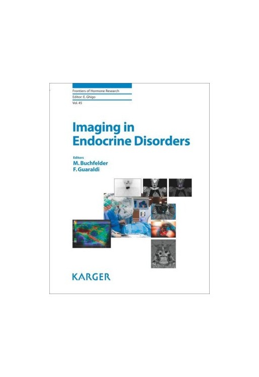 Imaging in Endocrine Disorders