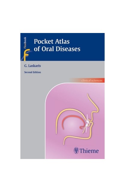 Pocket Atlas of Oral Diseases