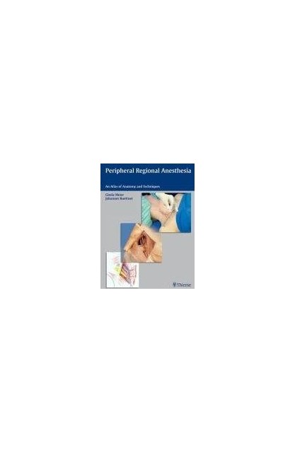 Peripheral Regional Anesthesia