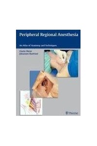 Peripheral Regional Anesthesia